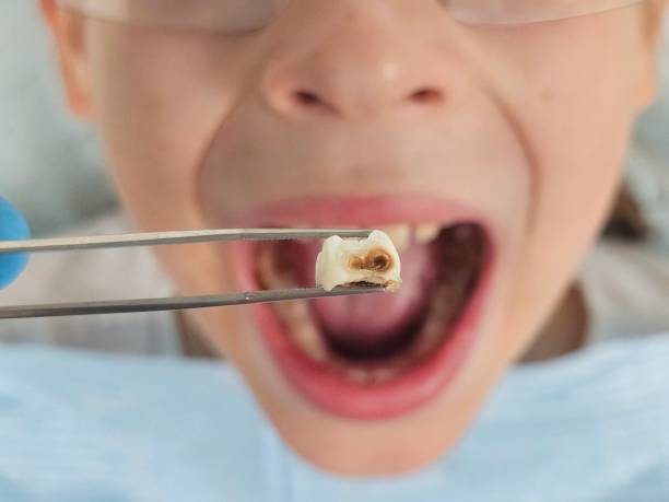 Best Tooth Infection Emergency Dentist  in Clatskanie, OR